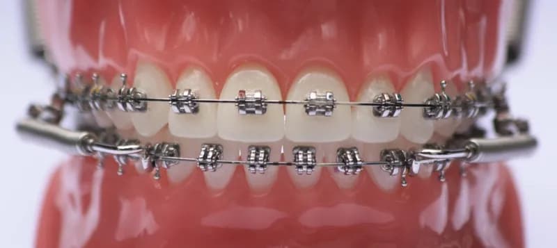 Ortho Waalwijk — foto uit de Google-vermelding van de praktijk