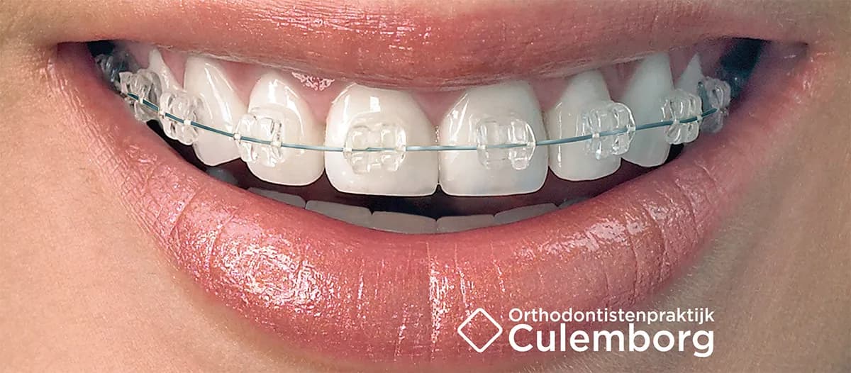 Orthodontistenpraktijk Culemborg — foto uit de Google-vermelding van de praktijk