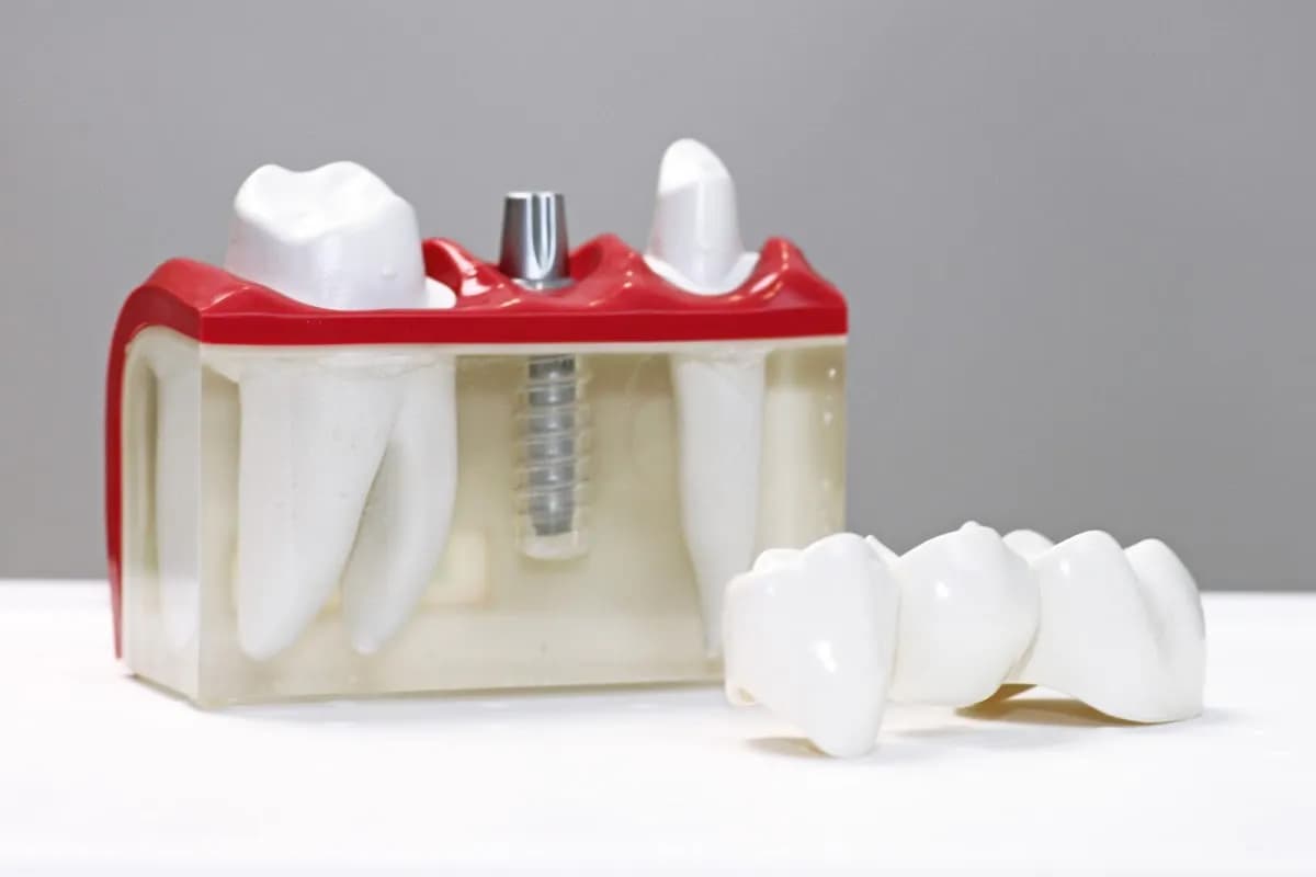 Tand.- & Implant.prakt. Aussems B.V. — foto uit de Google-vermelding van de praktijk