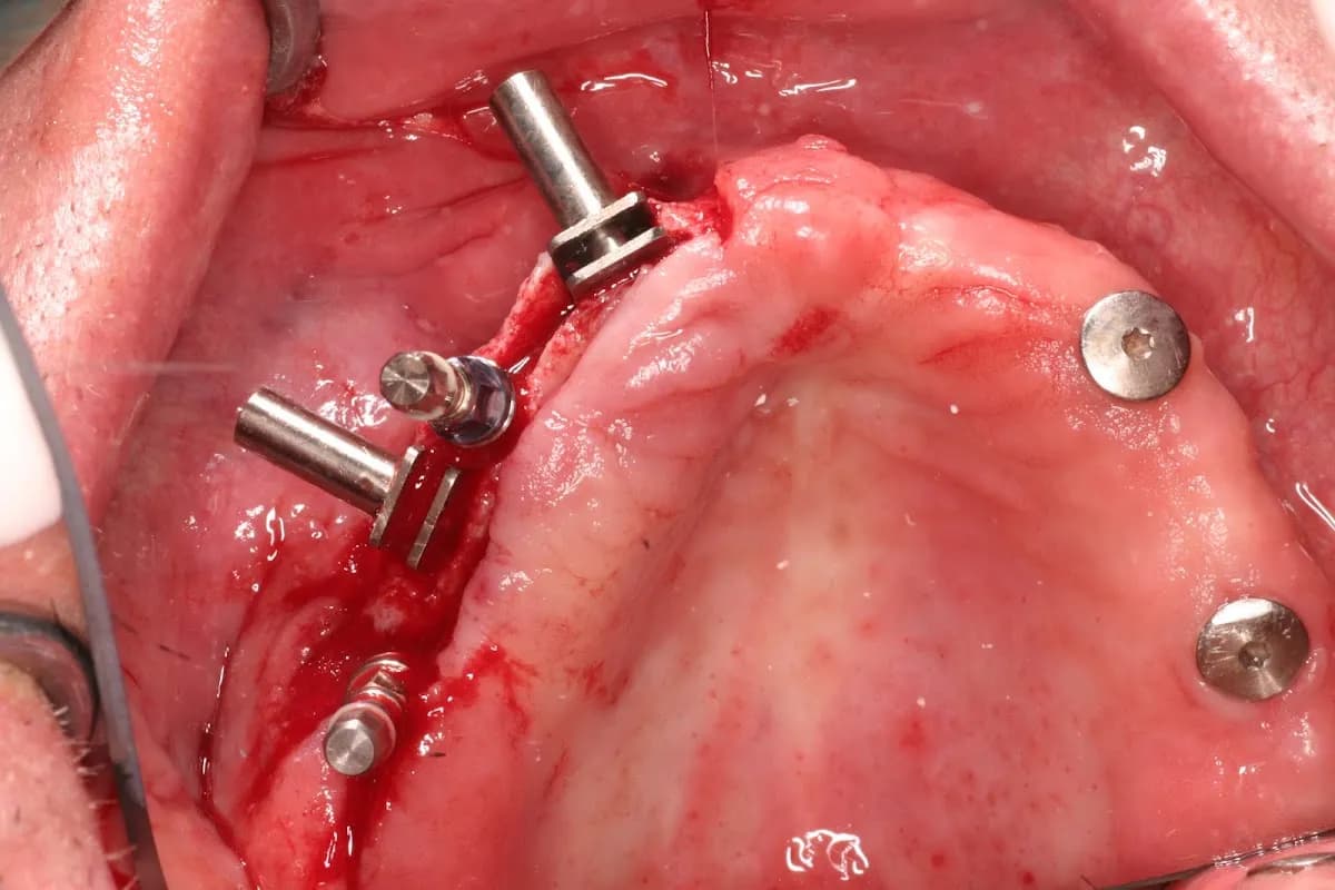 Tandarts Van der Kroft, Praktijk voor Orale Implantologie en Algemene Tandheelkunde B.V. — foto uit de Google-vermelding van de praktijk